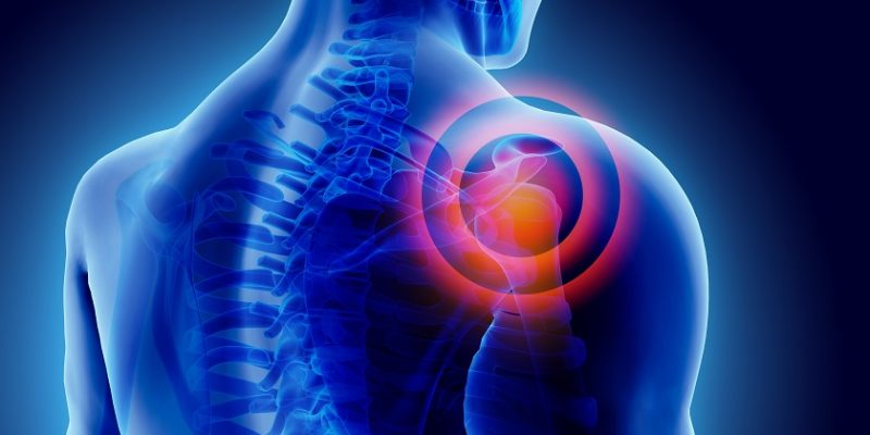 Symptoms and Causes of Frozen Shoulder and Shoulder Instability
