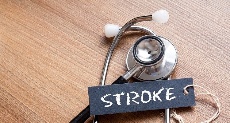 How to Spot a Stroke
