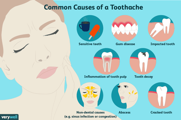 Common causes of toothaches